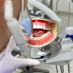 dental bridge